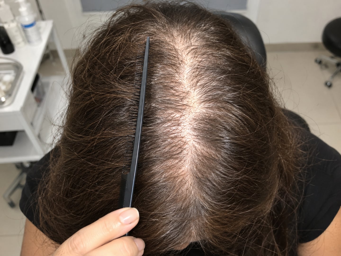 Falhas e Crescimento Lento — Antes
